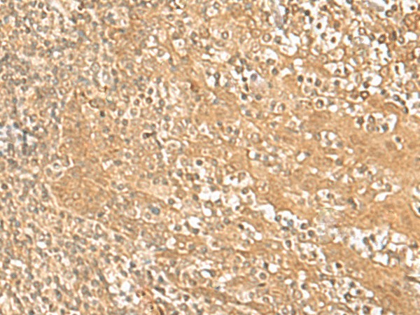 HMBOX1 Polyclonal Antibody (E-AB-18085)