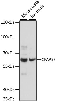 CFAP53 Polyclonal Antibody (E-AB-66873)
