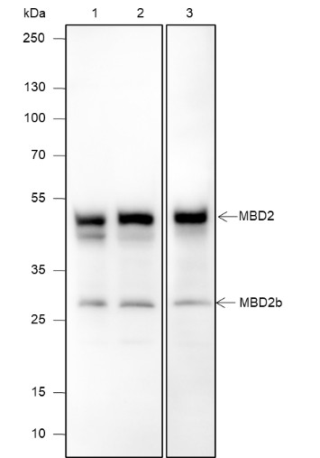 Recombinant MBD2 Monoclonal Antibody (AN301905L)