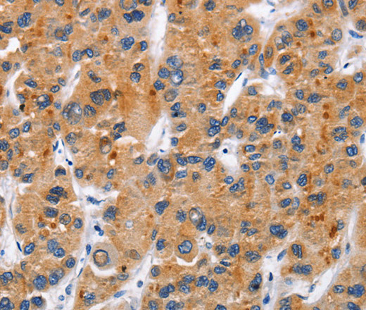 CD137 Polyclonal Antibody (E-AB-11041)