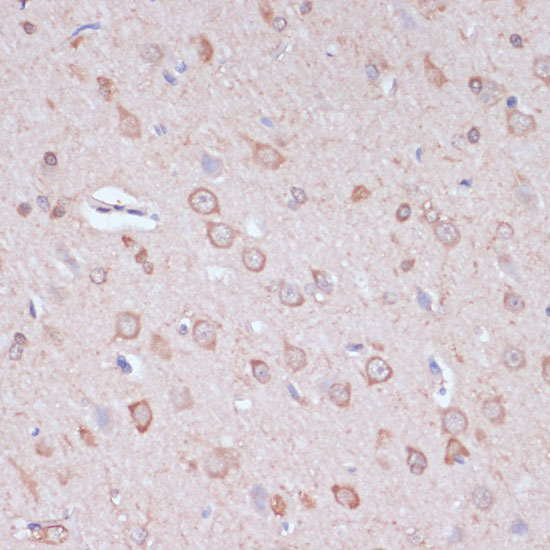 CARTPT Polyclonal Antibody (E-AB-67332)