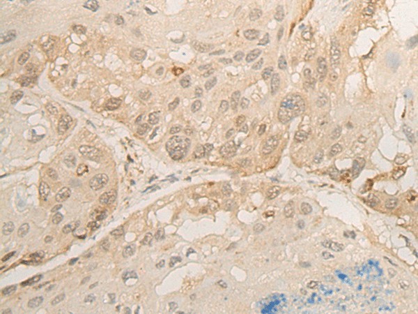 DROSHA Polyclonal Antibody (E-AB-17893)