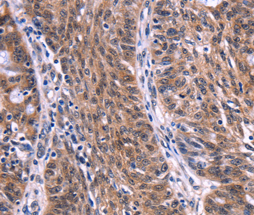 EIF2AK4 Polyclonal Antibody (E-AB-14733)