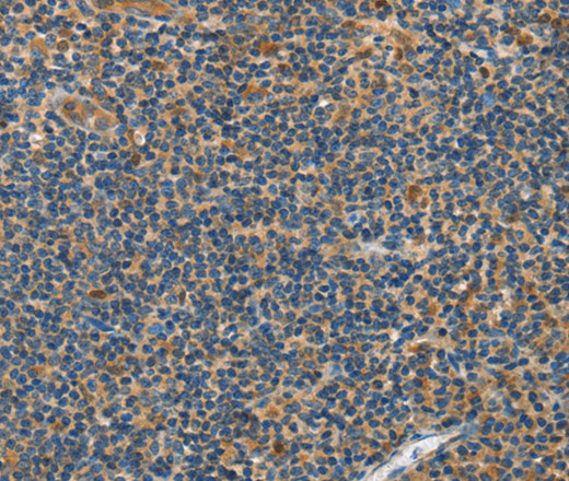 GRB7 Polyclonal Antibody (E-AB-14108)