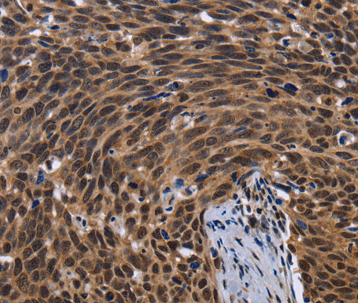 FASTKD5 Polyclonal Antibody (E-AB-11222)