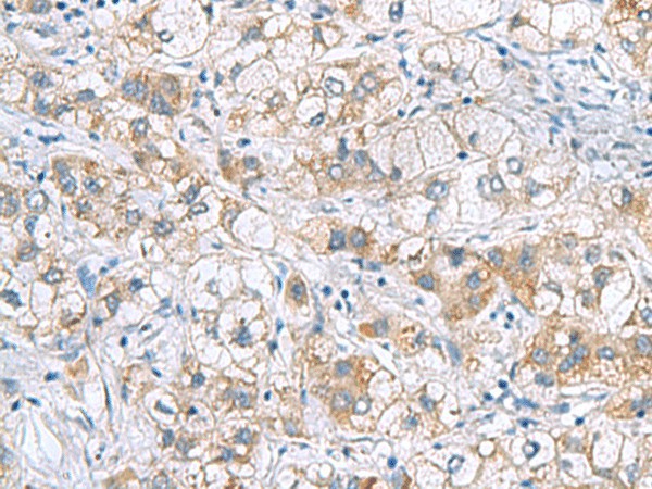 GCSH Polyclonal Antibody (E-AB-19143)