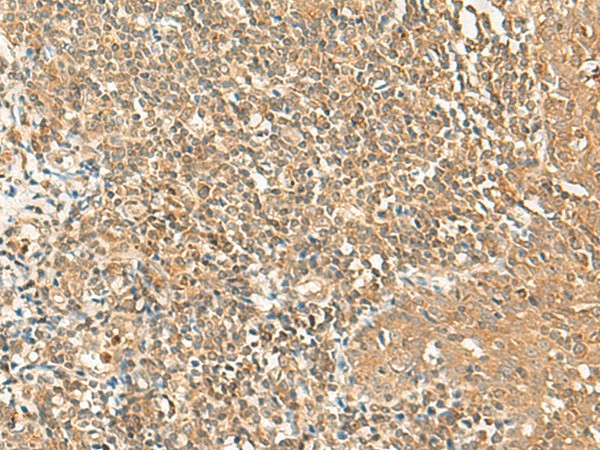 GRIPAP1 Polyclonal Antibody (E-AB-18052)