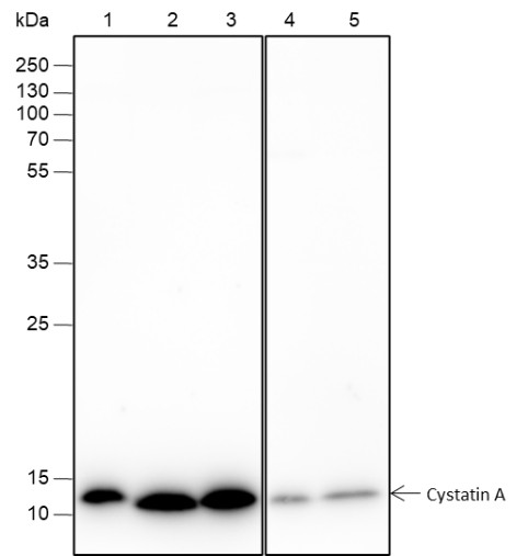 Recombinant Cystatin A Monoclonal Antibody (AN301505L)