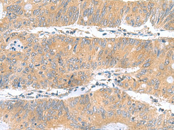 DNAL1 Polyclonal Antibody (E-AB-53049)