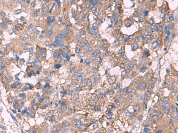 KCNN3 Polyclonal Antibody (E-AB-52084)