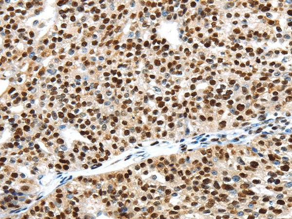 UBA1 Polyclonal Antibody (E-AB-17502)