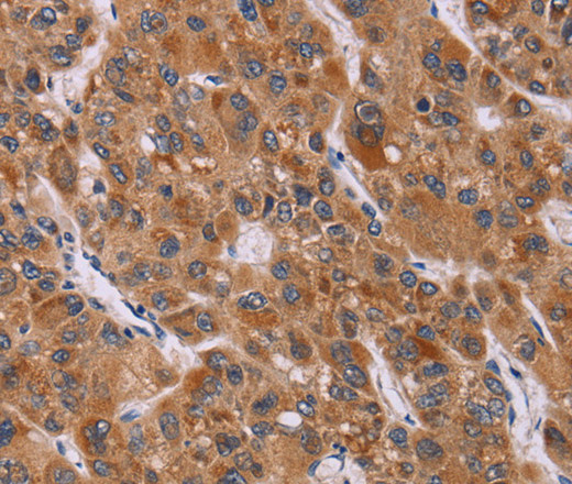 CALCA Polyclonal Antibody (E-AB-12338)