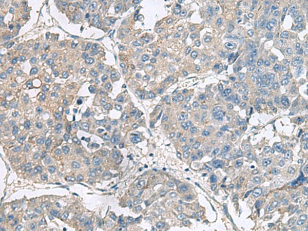 NPHP1 Polyclonal Antibody (E-AB-19106)