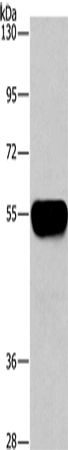 AHSG Polyclonal Antibody (E-AB-10780)