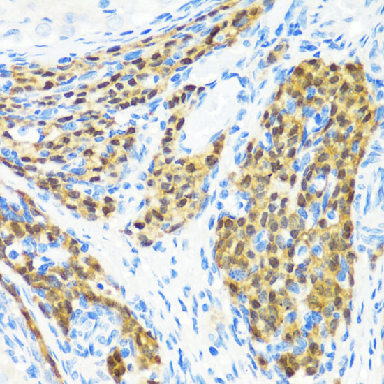 KMT2E Polyclonal Antibody (E-AB-61176)