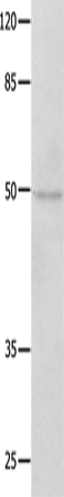 NAP1L1 Polyclonal Antibody (E-AB-14238)
