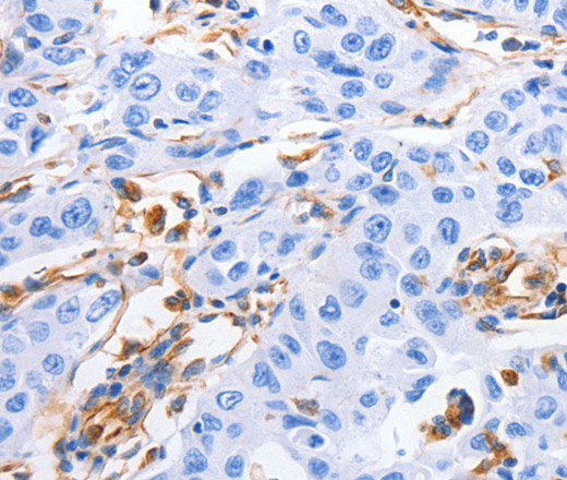 MFN1 Polyclonal Antibody (E-AB-10454)