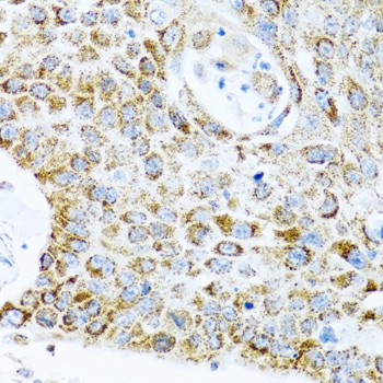 LRPPRC Polyclonal Antibody (E-AB-62333)
