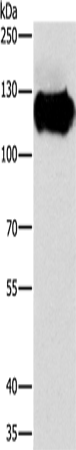 CAST Polyclonal Antibody (E-AB-14814)