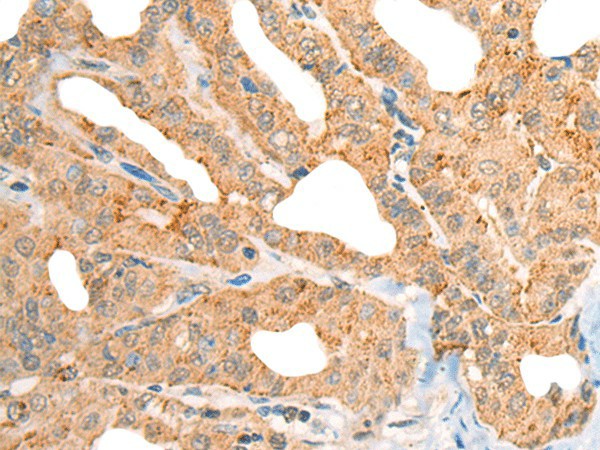 CECR1 Polyclonal Antibody (E-AB-52535)