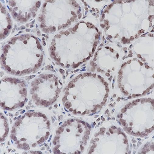 Recombinant ERCC1 Monoclonal Antibody (AN301517L)