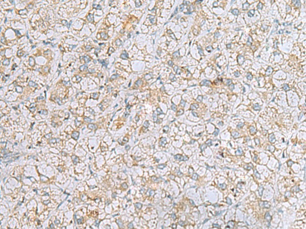 LRRC49 Polyclonal Antibody (E-AB-19521)