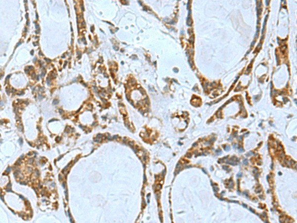 TSGA10 Polyclonal Antibody (E-AB-53009)