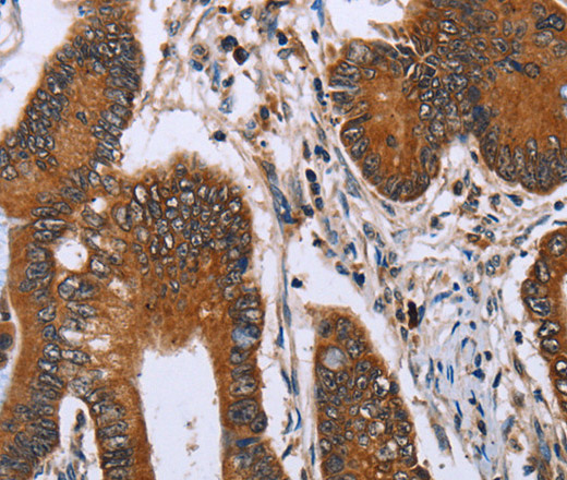 IHH Polyclonal Antibody (E-AB-11322)