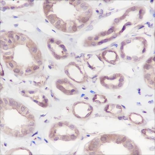 Recombinant Calpain small subunit 1 Monoclonal Antibody (AN301453L)