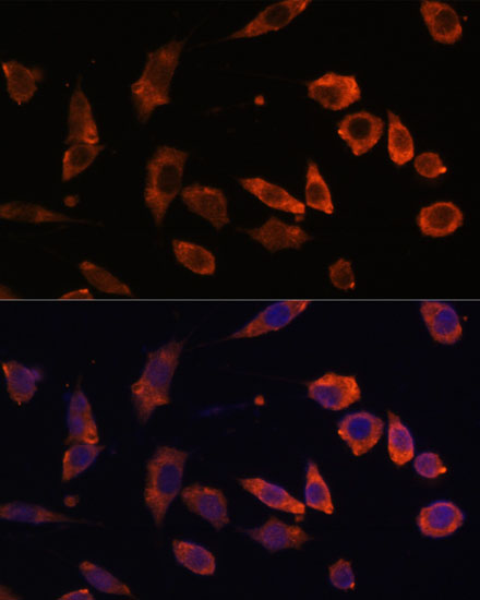 RAB5B Polyclonal Antibody (E-AB-67871)