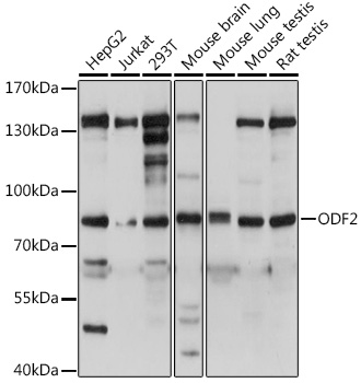 ODF2 Polyclonal Antibody (E-AB-91225)
