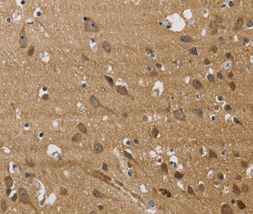 JAG1 Polyclonal Antibody (E-AB-16531)