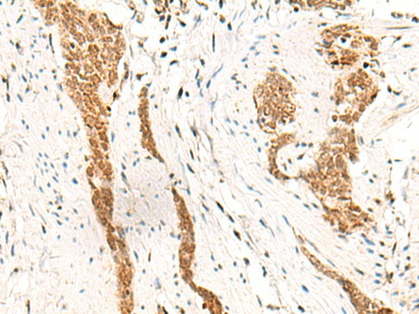 HOXC13 Polyclonal Antibody (E-AB-18092)