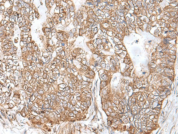 RNF111 Polyclonal Antibody (E-AB-18773)