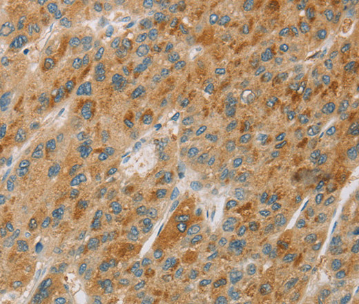 CYP11B1 Polyclonal Antibody (E-AB-14911)