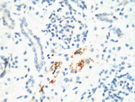 KIF7 Monoclonal Antibody (E-AB-22026)