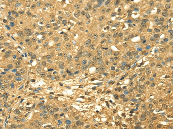 RPA2 Polyclonal Antibody (E-AB-17006)