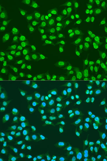 ATM Polyclonal Antibody (E-AB-66517)