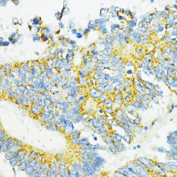 PD-L1 Polyclonal Antibody (E-AB-65810)