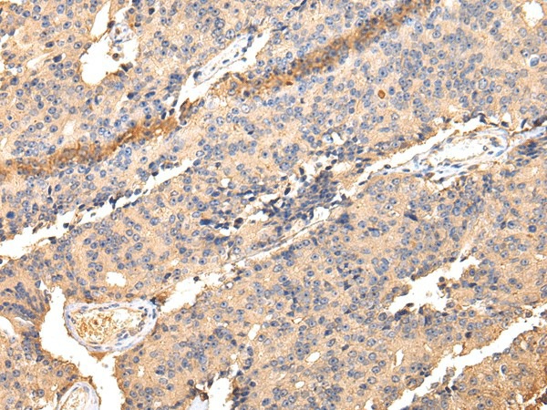 SDCBP Polyclonal Antibody (E-AB-17209)