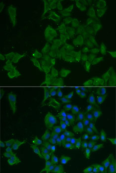 LGALS3BP Polyclonal Antibody (E-AB-61409)