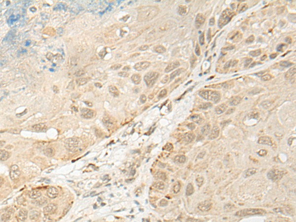 OTX1 Polyclonal Antibody (E-AB-52608)