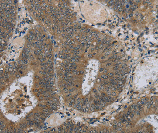 HSD3B1 Polyclonal Antibody (E-AB-11310)