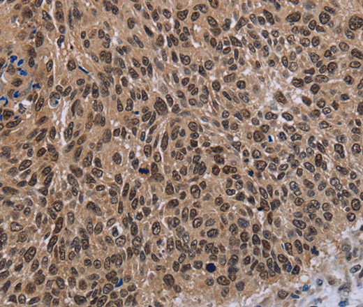 DLX4 Polyclonal Antibody (E-AB-11161)
