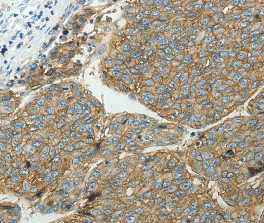 SLC16A1 Polyclonal Antibody (E-AB-15768)