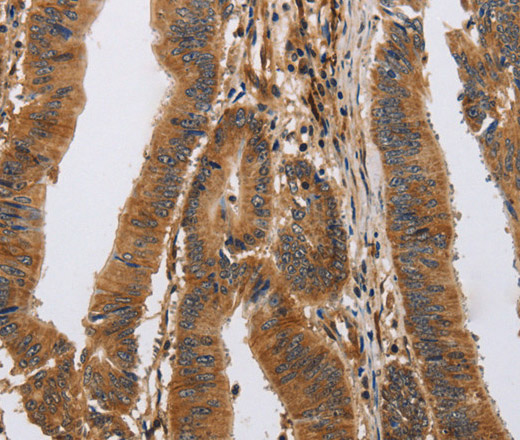 ITPR1 Polyclonal Antibody (E-AB-16529)