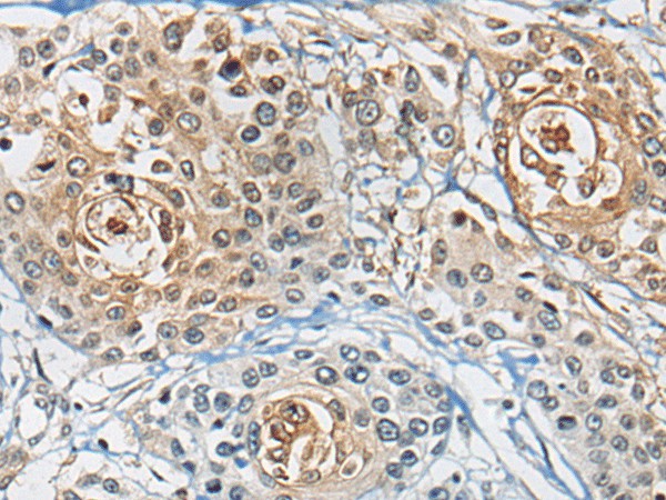 CD8A Polyclonal Antibody (E-AB-19675)