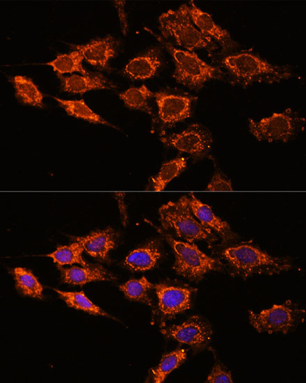 PASK Polyclonal Antibody (E-AB-65607)