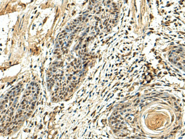NUTF2 Polyclonal Antibody (E-AB-18888)