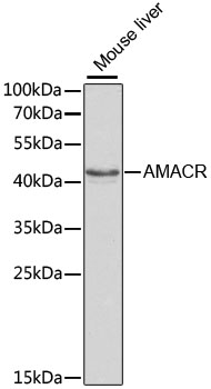 AMACR Polyclonal Antibody (E-AB-60199)